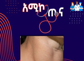 የእንቅርት በሽታ ምንድን ነው?