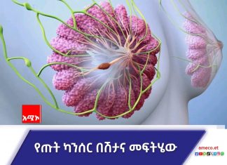 የጡት ካንሰር እና አሳሳቢነቱ።