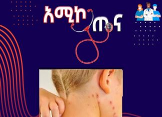 የውኃ ጉድፍ በሽታ ምንድን ነው?