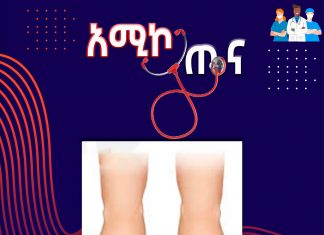 ስለ ጋንግሪን በሽታ ምን ያህል ያውቃሉ ?