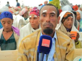 የቦሩ ሜዳ ጠቅላላ ሆስፒታል ነጻ የዐይን ሞራ ግርዶሽ ቀዶ ጥገና ሕክምና መስጠት ጀመረ።