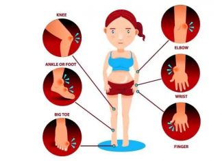 ስለሪህ በሽታ ምን እንወቅ?