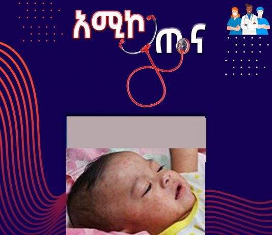 የኩፍኝ በሽታ ምንድን ነው?